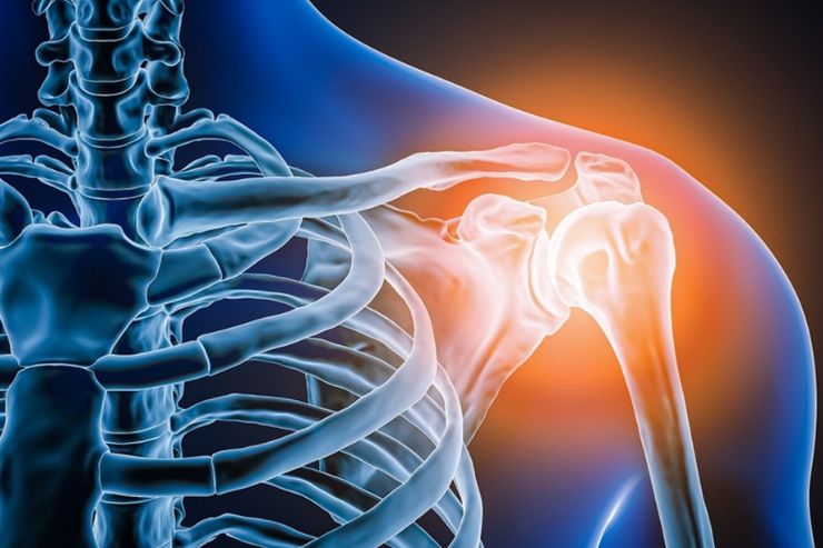 Shoulder Replacement Surgery - Dr. Rakesh Verma